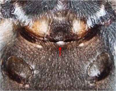 Smithi_Epigastralfurche_m.jpg